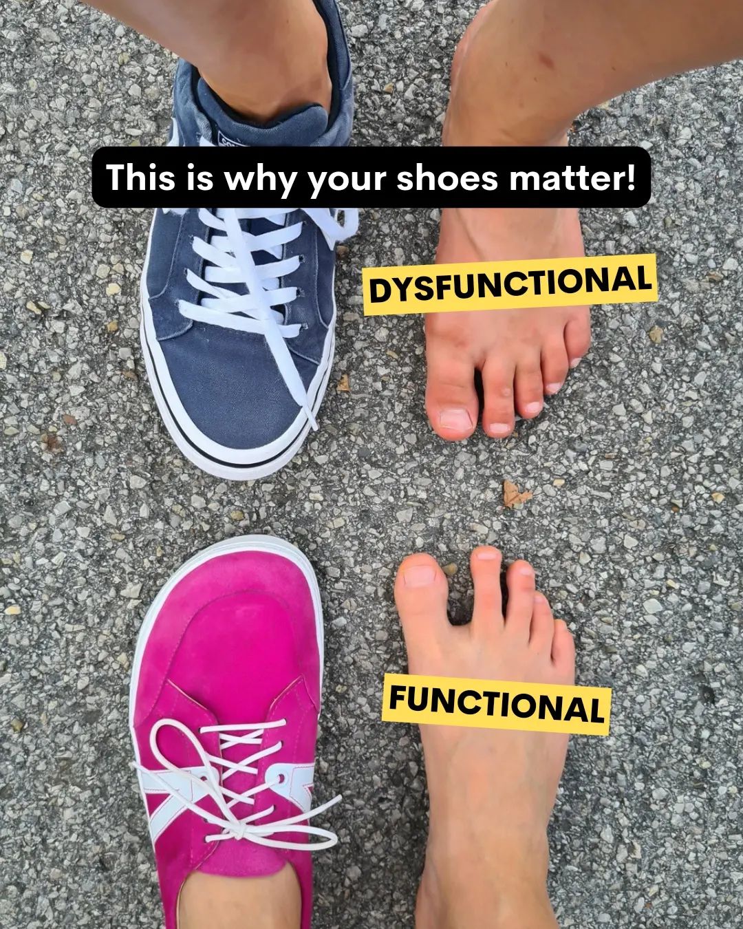 How to Safely Transition to Barefoot Shoes: A Guide for Newbies ...