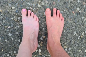 Two bare feet on a gravel surface showing natural toe splay and different foot shapes.